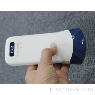 Scanner di ultrasuoni wireless più venduto da Sonostar